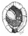 Illustration of Redbanded whitefly pupae