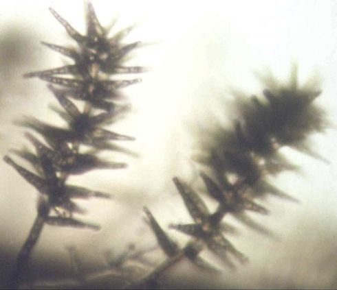 When examined under a microscope, the spore-bearing structures of the silver scurf pathogen, <I>Helminthosporium solani,</I> have a 