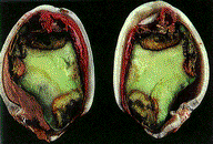 Internal necrosis caused by leaffooted bugs or stink bugs feeding after shell hardening.