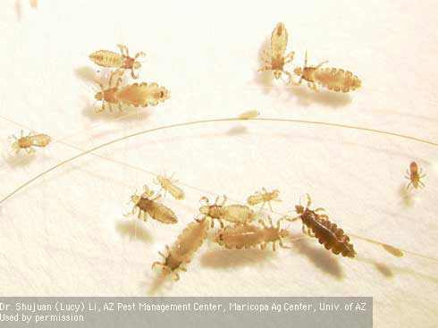 Eggs, nymphs, and adults of head lice, <i>Pediculus humanus capitis.</i>.