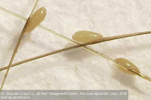 Eggs of head lice, <i>Pediculus humanus capitis,</i> attached to hair shafts.