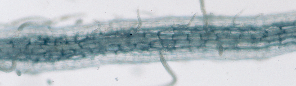 Root lesion nematode adults and eggs.