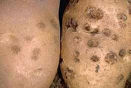 Superficial corky lesions of common scab