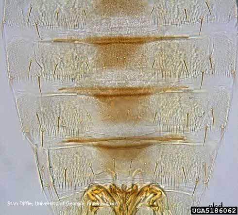 Highly magnified view of the top rear of the abdomen of chilli thrips, <i>Scirtothrips dorsalis</i>, showing the pattern of three seatae (tiny hairs) near the outer margin of each segment and dark areas that help to identify this species.