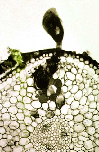 An adult female citrus nematodes, <i>Tylenchulus semipenetrans,</i> shown imbedded in a root cut in cross section. The  nematode's front end is deep inside the root tissue while the rear end remains outside of the root.