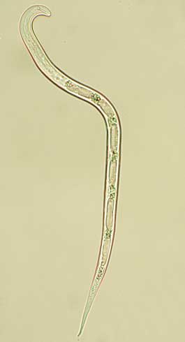 Second-stage juvenile (J2) of the citrus nematode, <i>Tylenchulus semipenetrans.</i>.