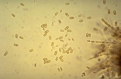 Ascospores of the apple scab pathogen, Venturia inaequalis.