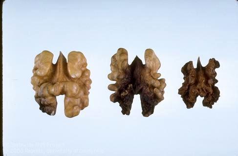 Walnut kernels darkened and shriveled due to sunburn next to a healthy kernel (left).