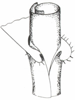 Illustration of collar with rounded auricles