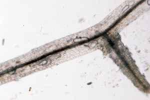 They might be difficult to see, but there are lesion nematodes in this root. Credit: Jack Kelly Clark, UC IPM. Copyright 2021 Regents of the University of California. Photo by: Jack Kelly Clark, UC IPM. Copyright 2021 Regents of the University of California.